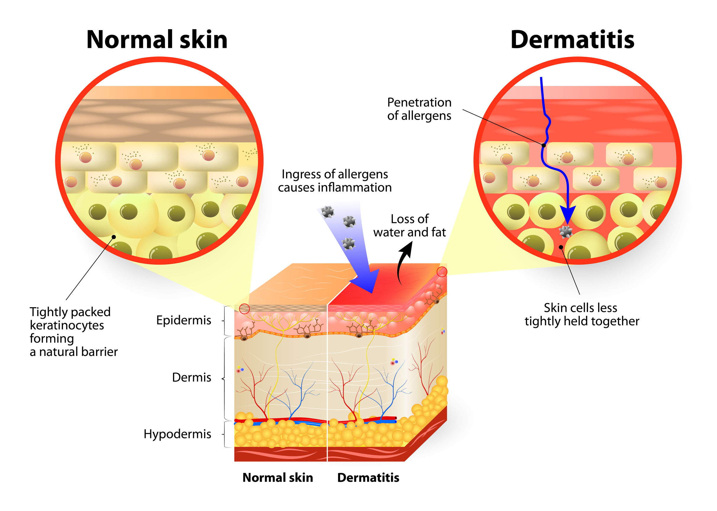 Cosmeceutical Skin Reactions